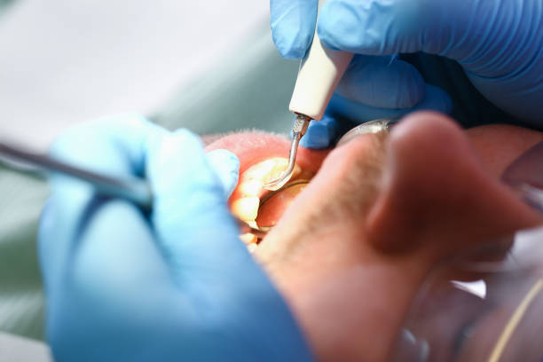 Best Emergency Denture Repair in Gerdine, AL